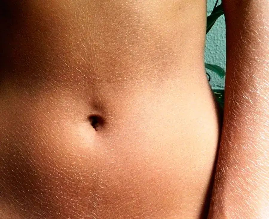Resultado de bronzeamento na região abdominal